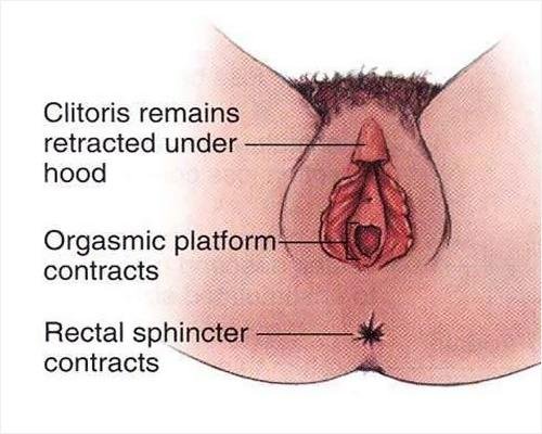 #53 3 Orgazm Engelleyiciler ve Dr. Tara ile Cinsel Kimyanın Önemi 3 - İpucu Dolu Öneriler: Orgazmı Engelleyen Faktörler ve Çözümleri